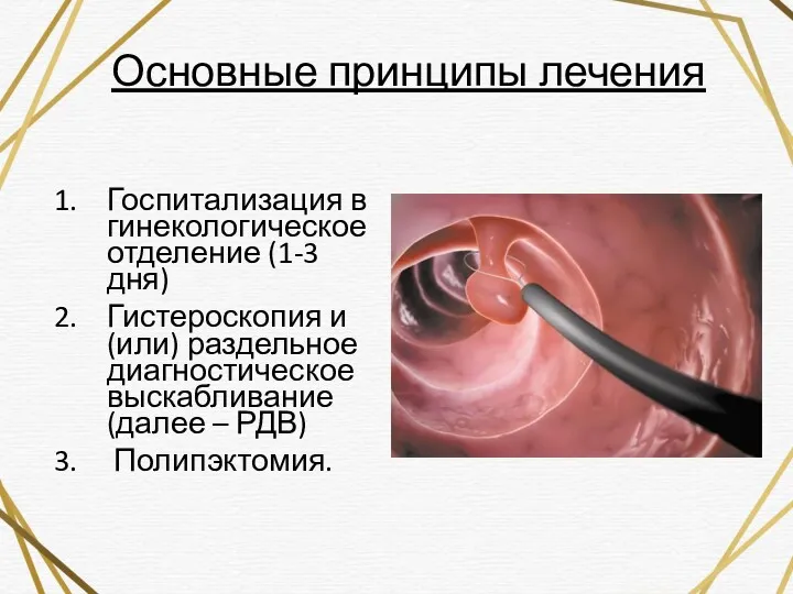 Основные принципы лечения Госпитализация в гинекологическое отделение (1-3 дня) Гистероскопия