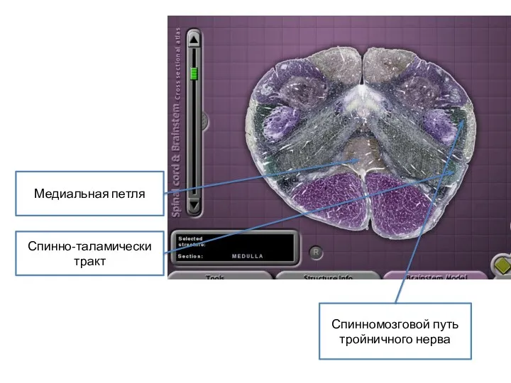 Спинно-таламически тракт Медиальная петля Спинномозговой путь тройничного нерва