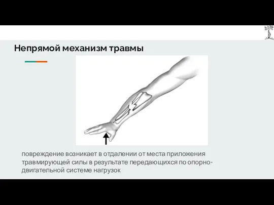 Непрямой механизм травмы повреждение возникает в отдалении от места приложения