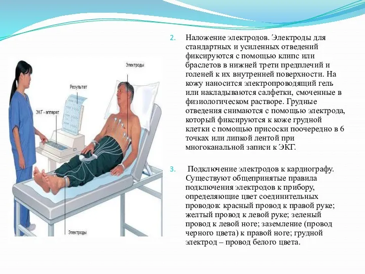 Наложение электродов. Электроды для стандартных и усиленных отведений фиксируются с