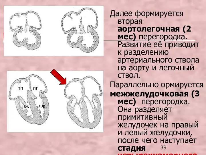 Далее формируется вторая аортолегочная (2 мес) перегородка. Развитие её приводит