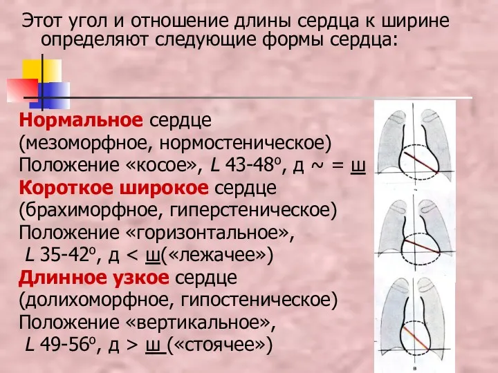 Нормальное сердце (мезоморфное, нормостеническое) Положение «косое», L 43-48о, д ~