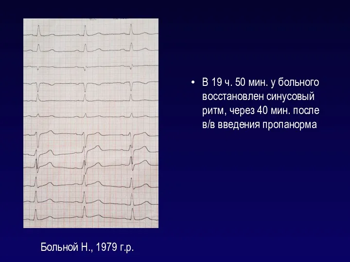 Больной Н., 1979 г.р. В 19 ч. 50 мин. у больного восстановлен синусовый