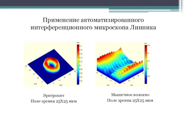 Применение автоматизированного интерференционного микроскопа Линника Эритроцит Поле зрения 25X25 мкм Мышечное волокно Поле зрения 25X25 мкм