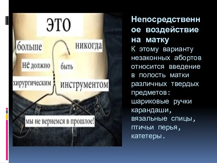 Непосредственное воздействие на матку К этому варианту незаконных абортов относится введение в полость