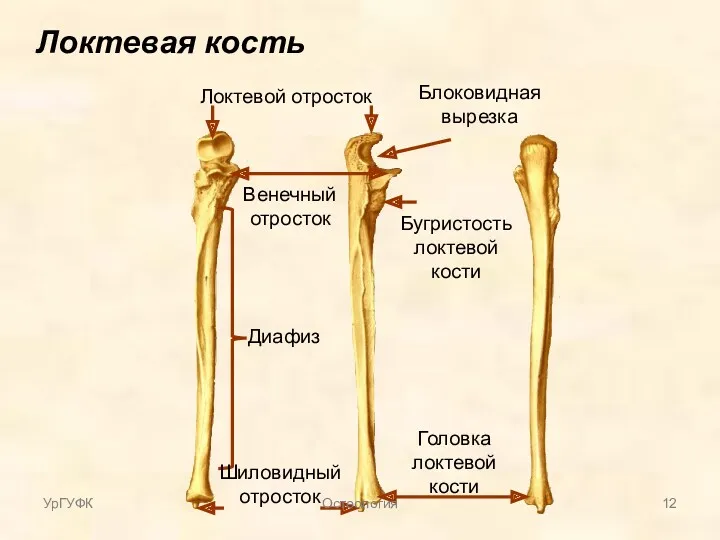 Локтевая кость Диафиз Локтевой отросток Венечный отросток Блоковидная вырезка Головка