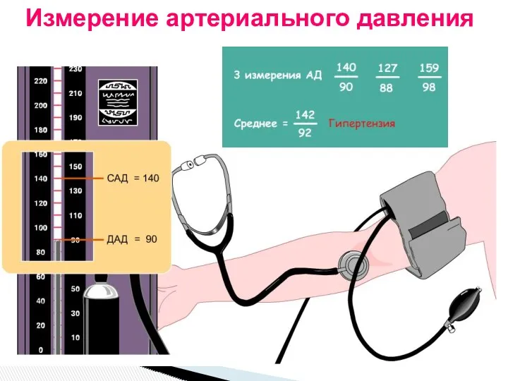 Измерение артериального давления