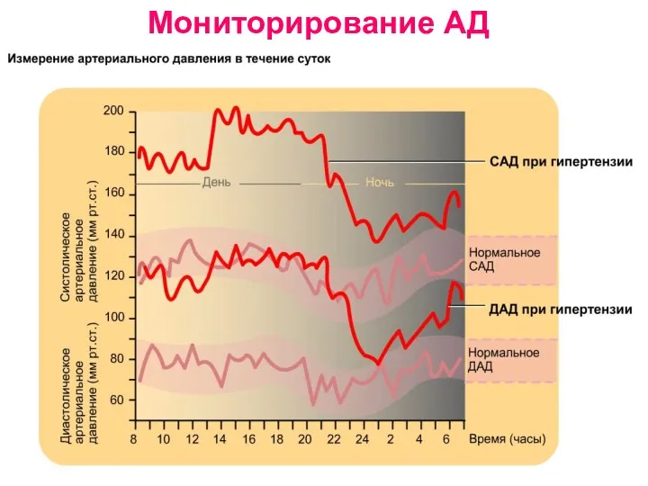 Мониторирование АД