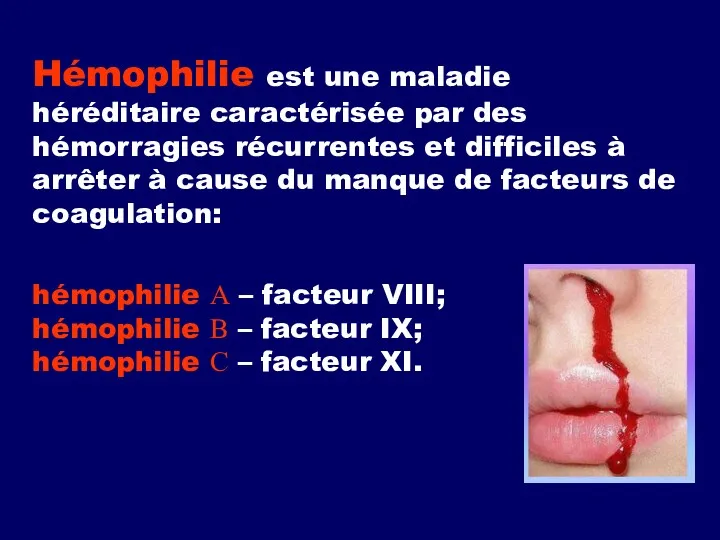 Hémophilie est une maladie héréditaire caractérisée par des hémorragies récurrentes