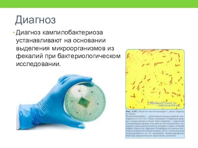 Диагноз Диагноз кампилобактериоза устанавливают на основании выделения микроорганизмов из фекалий при бактериологическом исследовании.