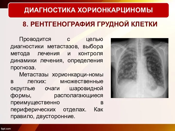 Проводится с целью диагностики метастазов, выбора метода лечения и контроля