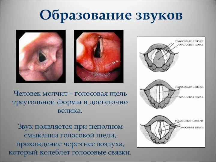 Образование звуков Человек молчит – голосовая щель треугольной формы и достаточно велика. Звук