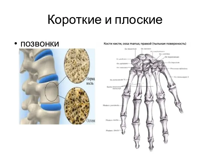 Короткие и плоские позвонки