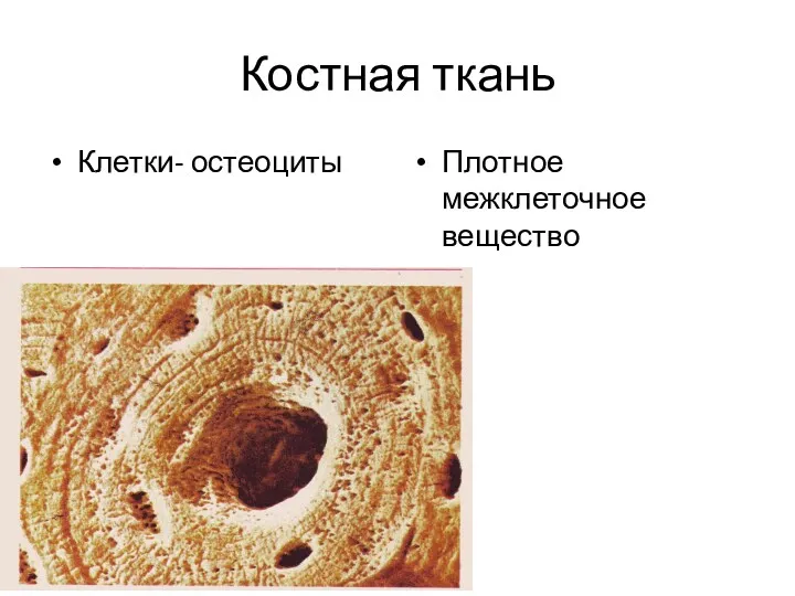 Костная ткань Клетки- остеоциты Плотное межклеточное вещество