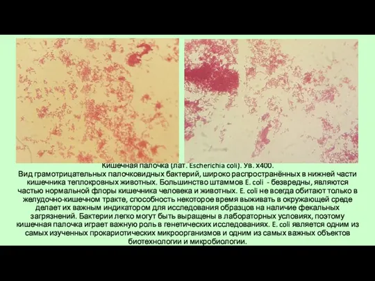 Кишечная палочка (лат. Escherichia coli). Ув. х400. Вид грамотрицательных палочковидных