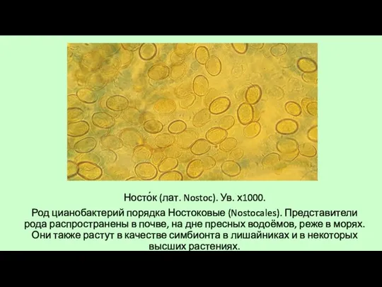 Носто́к (лат. Nostoc). Ув. х1000. Род цианобактерий порядка Ностоковые (Nostocales).