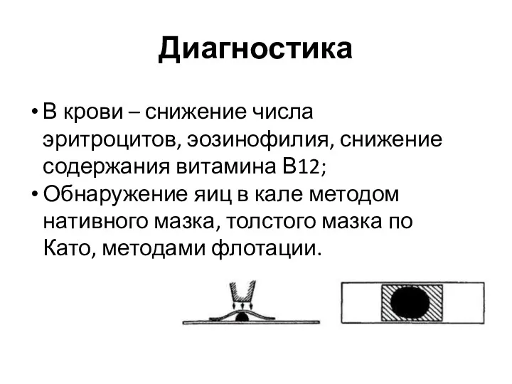 Диагностика В крови – снижение числа эритроцитов, эозинофилия, снижение содержания