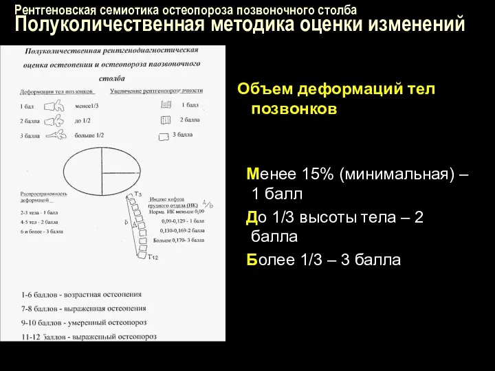 Рентгеновская семиотика остеопороза позвоночного столба Полуколичественная методика оценки изменений Объем деформаций тел позвонков