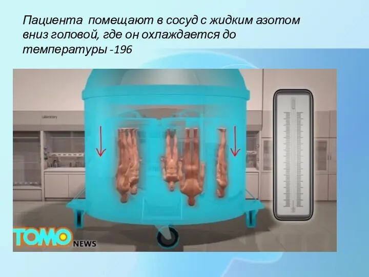 Пациента помещают в сосуд с жидким азотом вниз головой, где он охлаждается до температуры -196