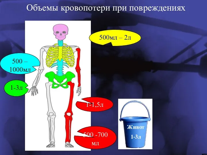 500 -700мл 500мл – 2л 1-3л 500 – 1000мл Объемы кровопотери при повреждениях 1-1,5л