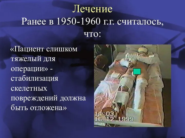 Ранее в 1950-1960 г.г. считалось, что: «Пациент слишком тяжелый для