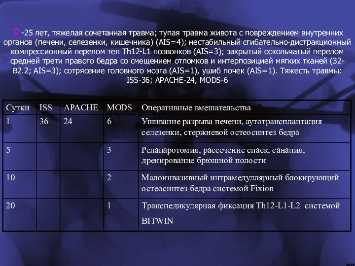 ♀-25 лет, тяжелая сочетанная травма; тупая травма живота с повреждением