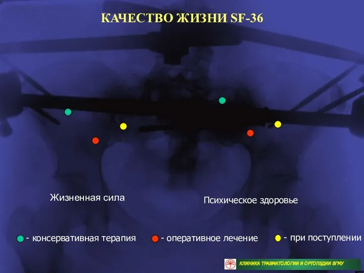 Жизненная сила Психическое здоровье КАЧЕСТВО ЖИЗНИ SF-36