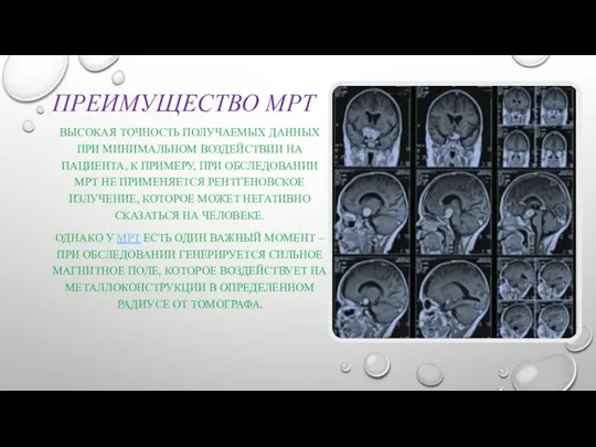 ПРЕИМУЩЕСТВО МРТ ВЫСОКАЯ ТОЧНОСТЬ ПОЛУЧАЕМЫХ ДАННЫХ ПРИ МИНИМАЛЬНОМ ВОЗДЕЙСТВИИ НА