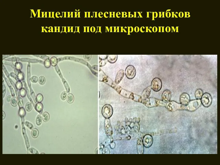 Мицелий плесневых грибков кандид под микроскопом