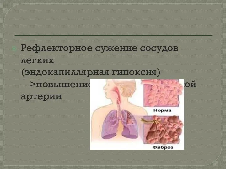 Рефлекторное сужение сосудов легких (эндокапиллярная гипоксия) ->повышение давления в легочной артерии