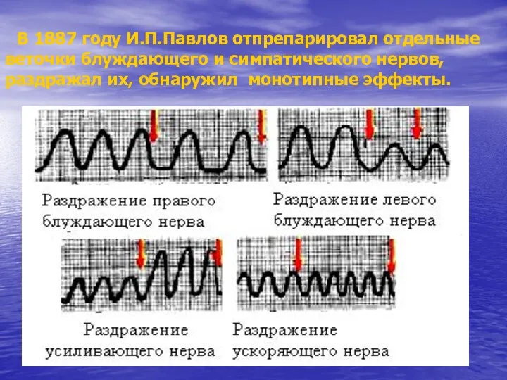 В 1887 году И.П.Павлов отпрепарировал отдельные веточки блуждающего и симпатического нервов, раздражал их, обнаружил монотипные эффекты.