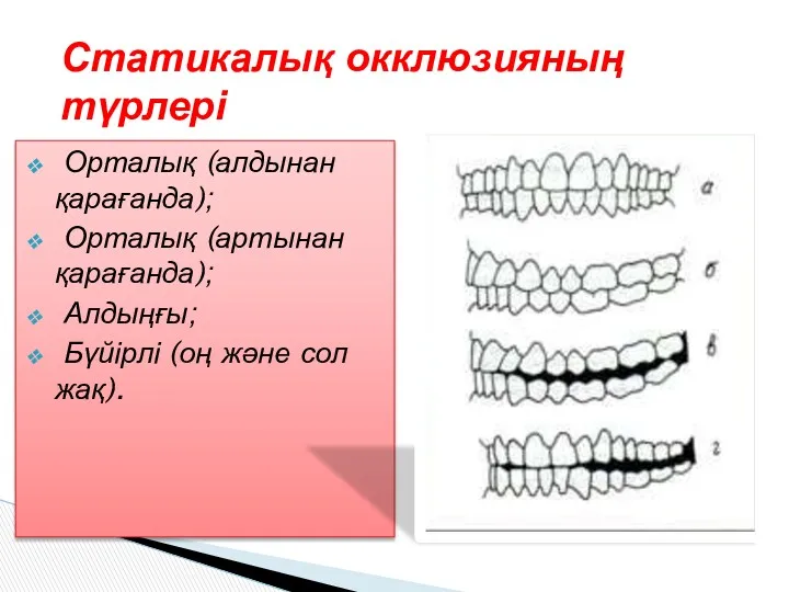 Орталық (алдынан қарағанда); Орталық (артынан қарағанда); Алдыңғы; Бүйірлі (оң және сол жақ). Статикалық окклюзияның түрлері