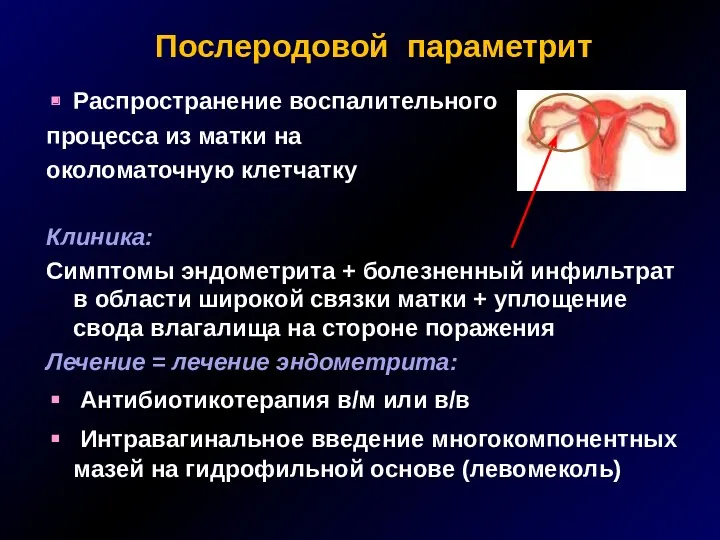 Послеродовой параметрит Распространение воспалительного процесса из матки на околоматочную клетчатку