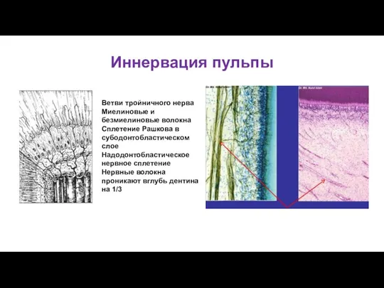 Иннервация пульпы Ветви тройничного нерва Миелиновые и безмиелиновые волокна Сплетение Рашкова в субодонтобластическом