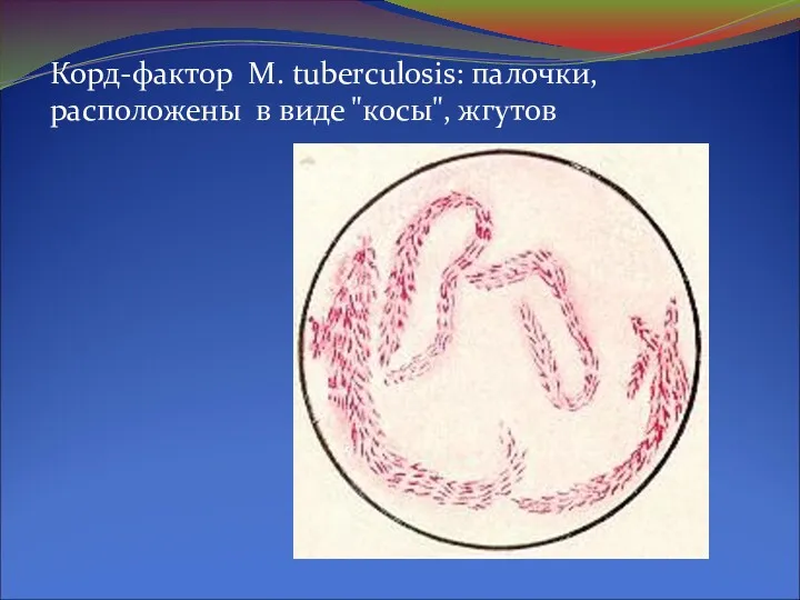 Корд-фактор M. tuberculosis: палочки, расположены в виде "косы", жгутов Корд-факторM.tuberculosis: палочки, расположены в виде "косы", жгутов