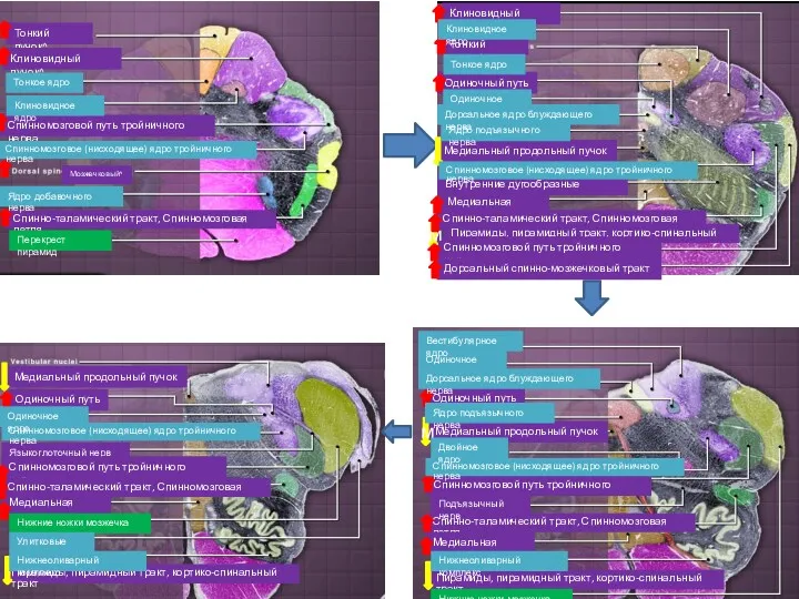 Тонкий пучок^ Клиновидный пучок^ Мозжечковый^ Спинномозговой путь тройничного нерва Тонкий