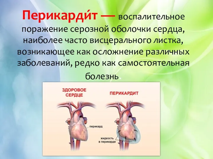 Перикарди́т — воспалительное поражение серозной оболочки сердца, наиболее часто висцерального