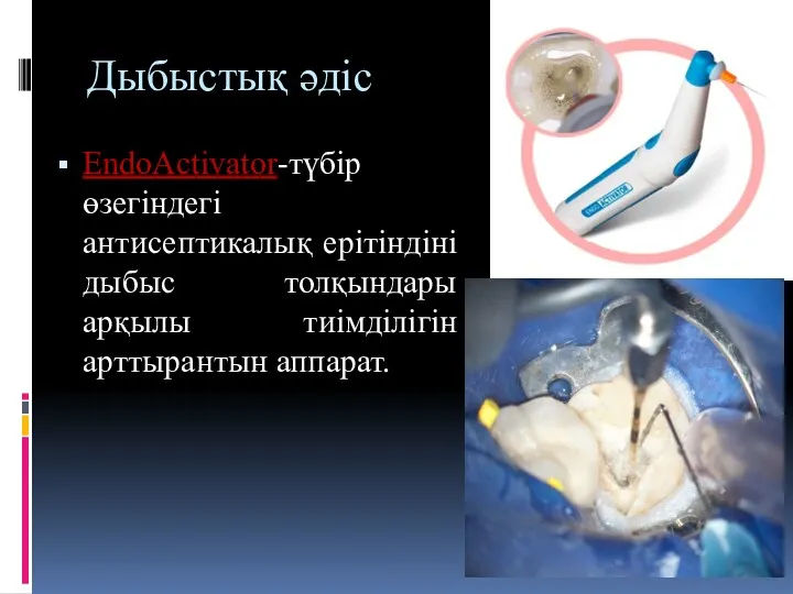 Дыбыстық әдіс EndoActivator-түбір өзегіндегі антисептикалық ерітіндіні дыбыс толқындары арқылы тиімділігін арттырантын аппарат.