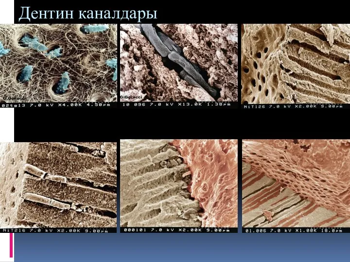 Дентин каналдары