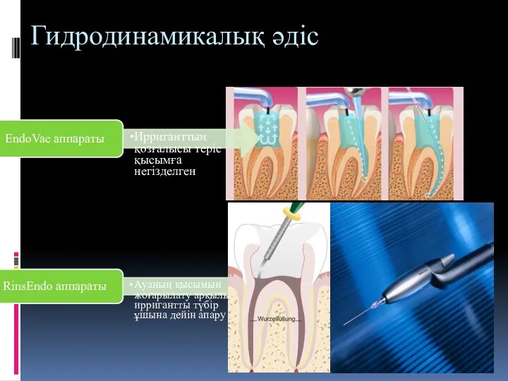 Гидродинамикалық әдіс EndoVac аппараты Ирриганттың қозғалысы теріс қысымға негізделген RinsEndo