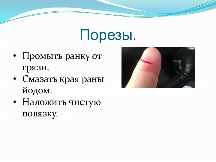 Порезы. Промыть ранку от грязи. Смазать края раны йодом. Наложить чистую повязку.