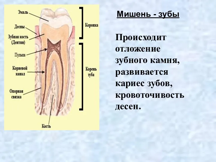 Мишень - зубы Происходит отложение зубного камня, развивается кариес зубов, кровоточивость десен.
