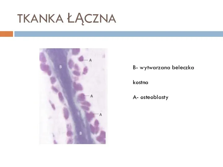 TKANKA ŁĄCZNA B- wytwarzana beleczka kostna A- osteoblasty