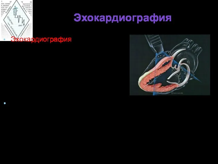 Эхокардиография Эхокардиография – это метод УЗИ, направленный на исследование морфологических