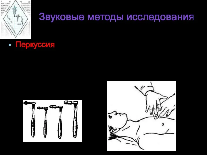 Звуковые методы исследования Перкуссия – анализ звуков, возникающих при простукивании