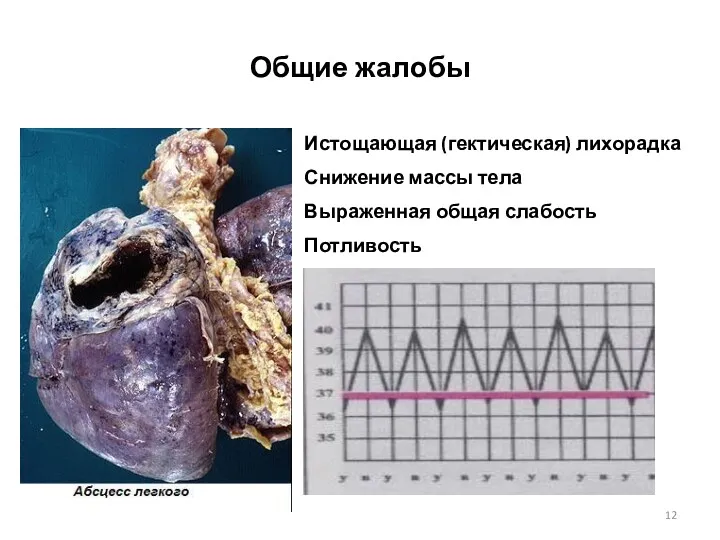 Общие жалобы Истощающая (гектическая) лихорадка Снижение массы тела Выраженная общая слабость Потливость