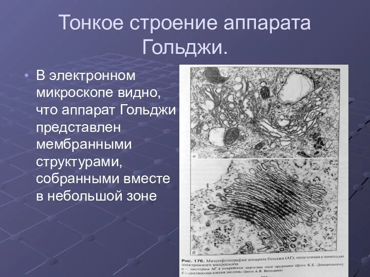 Тонкое строение аппарата Гольджи. В электронном микроскопе видно, что аппарат