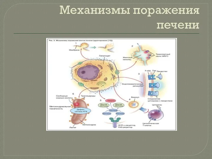 Механизмы поражения печени