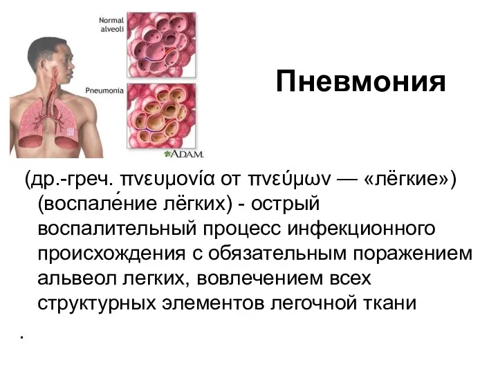 Пневмония (др.-греч. πνευμονία от πνεύμων — «лёгкие») (воспале́ние лёгких) -