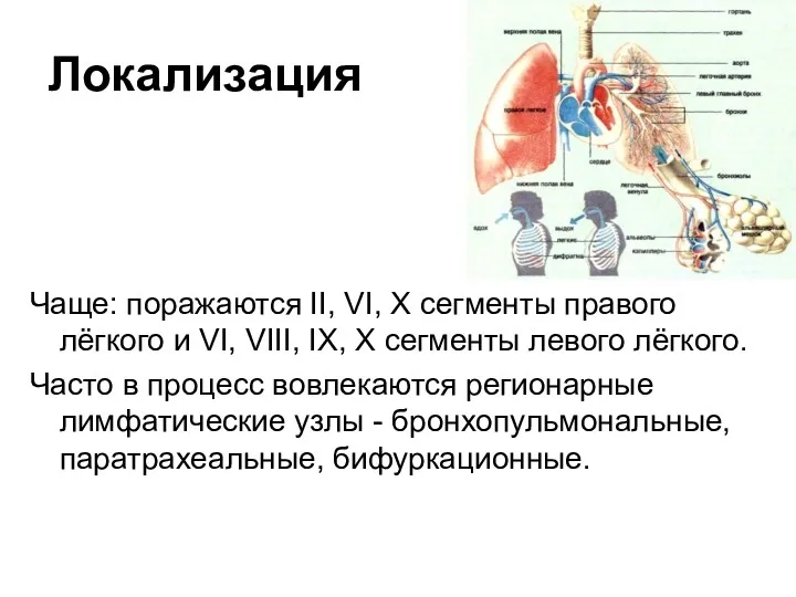 Локализация Чаще: поражаются II, VI, X сегменты правого лёгкого и